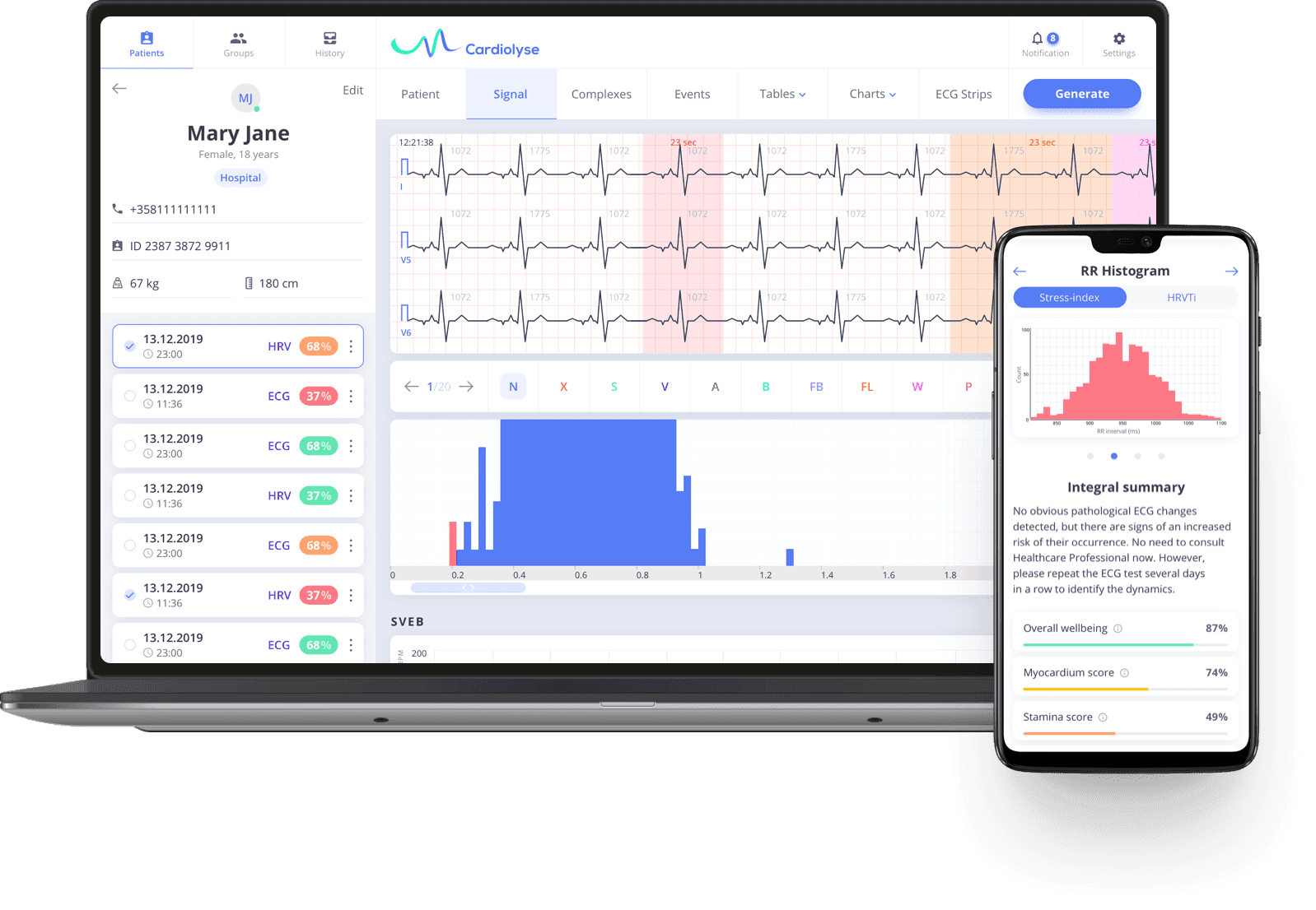Remote cardiac monitoring