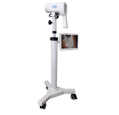 Compact video colposcope SLV - 101 HDm