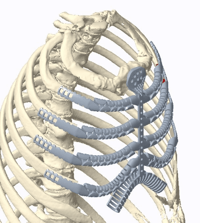 thoracic surgery